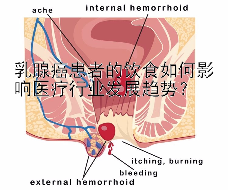 乳腺癌患者的饮食如何影响医疗行业发展趋势？